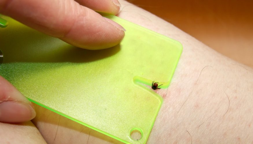 zecken-entfernen Zecken entfernen – Soll man sie vorher betäuben?