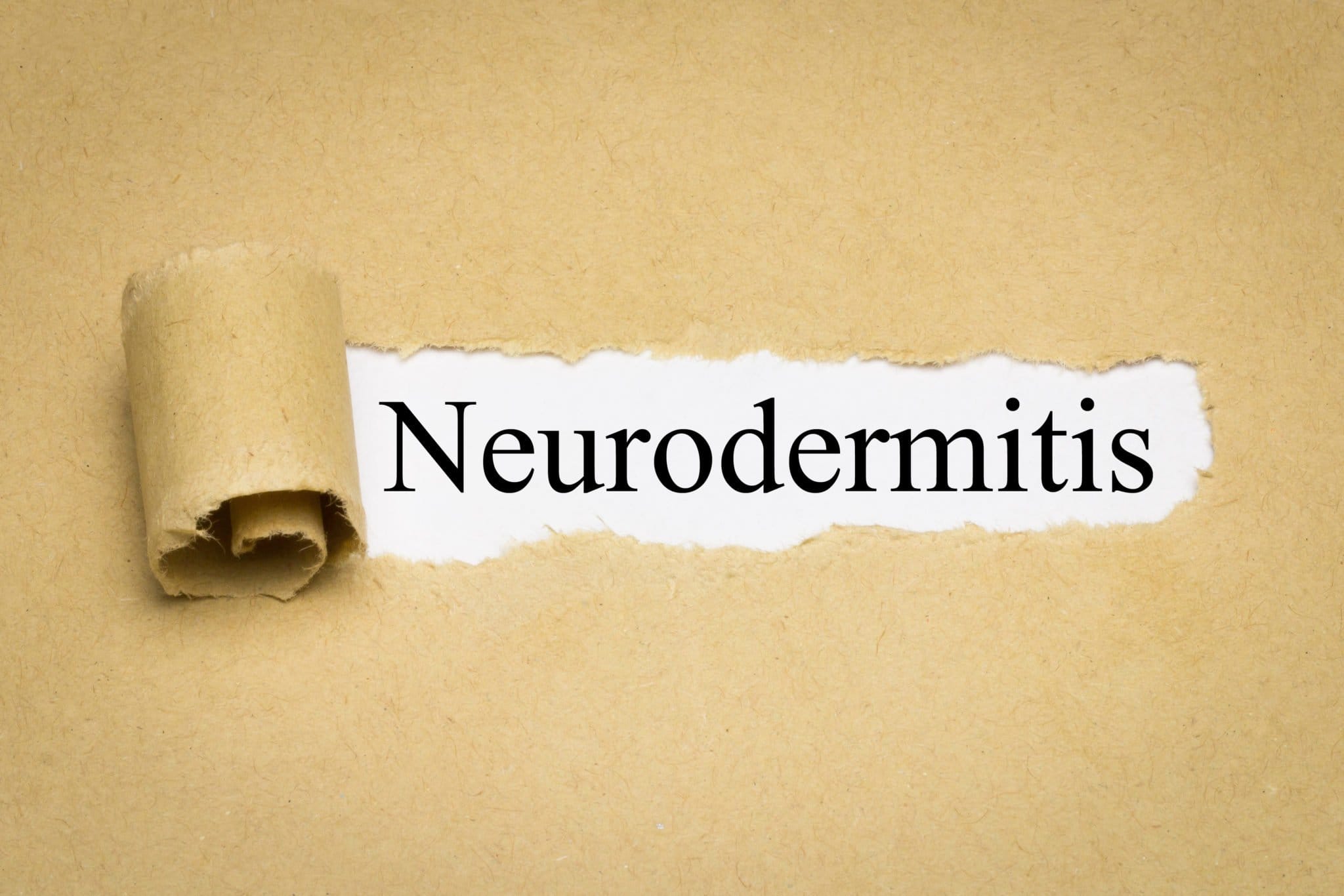 NeurodermitisCreme Test » Die besten Modelle für 2024 im Vergleich
