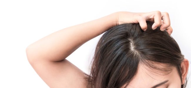 Entzündete Kopfhaut: Ursachen, Hausmittel und Tipps zur Behandlung