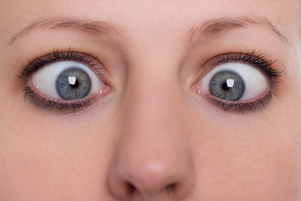 Können Die Augen Beim Schielen Stehen Bleiben www.haushaltstipps.net