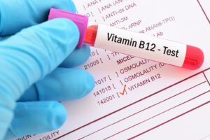 Vitamin B12 Mangel feststellen
