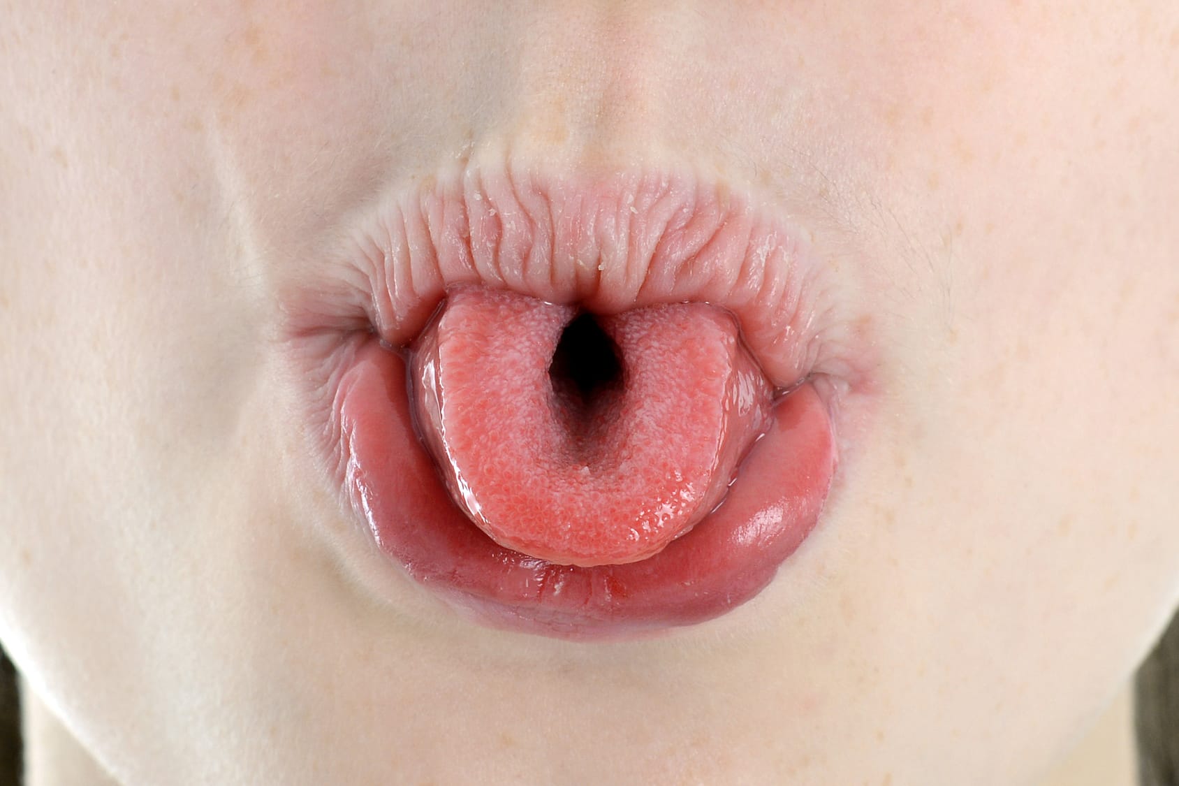 Zunge rollen – Ist diese Fähigkeit genetisch angelegt?