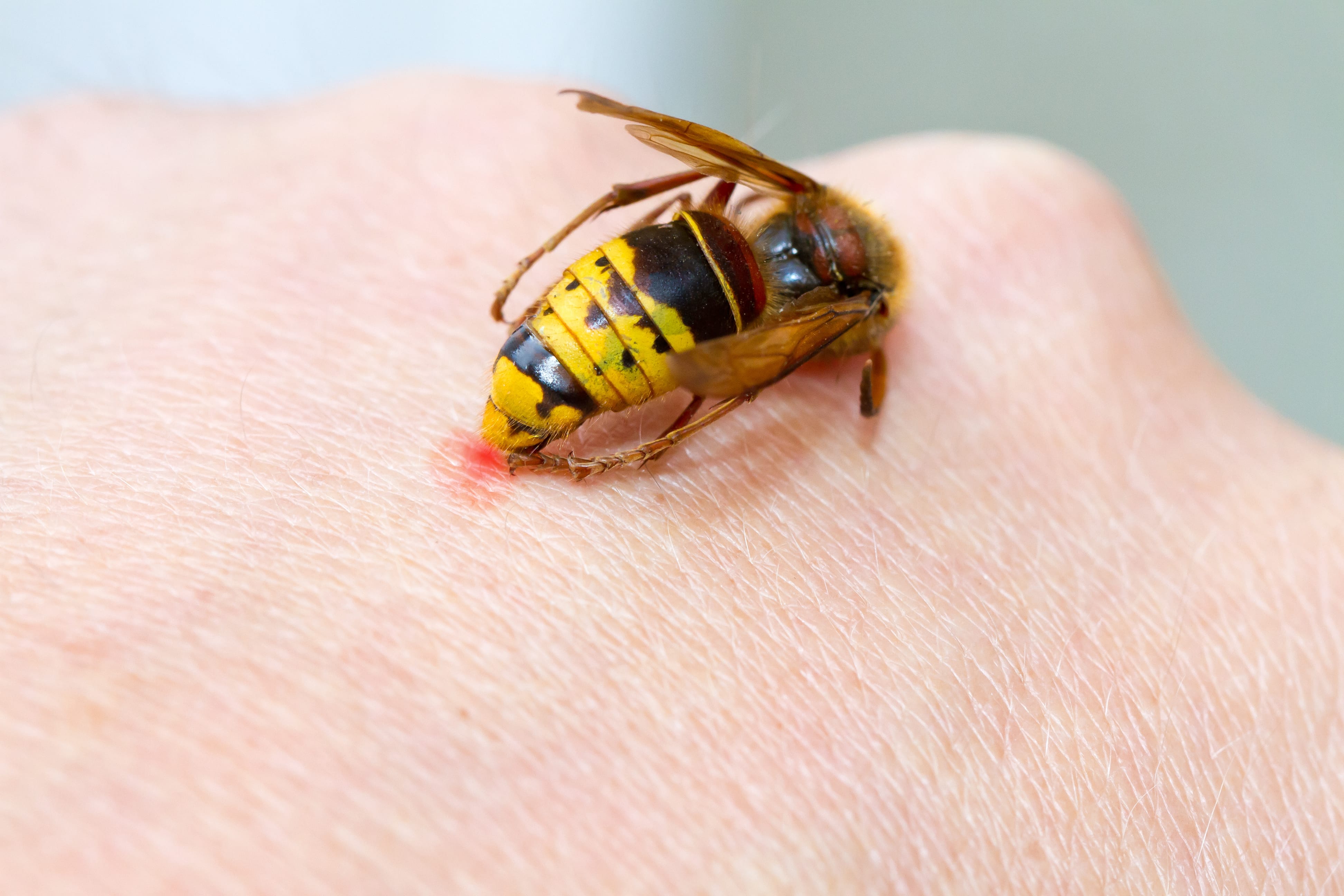 https://www.haushaltstipps.net/wp-content/uploads/zwiebeln-gegen-stiche Zwiebel gegen Insektenstiche
